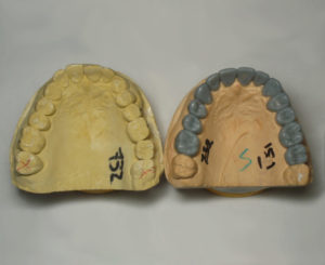 Wax up bottom before and after