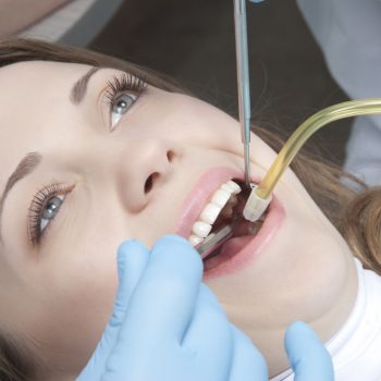 Explore fillings at Ian Smith DDS