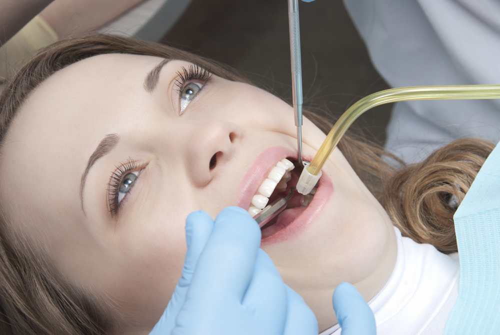 Explore fillings at Ian Smith DDS